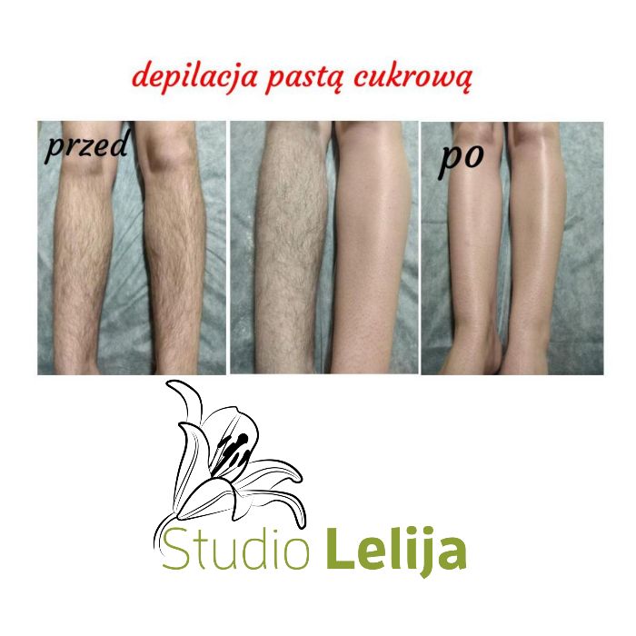 Depilacja pastą cukrową całego ciała - damska i męska.