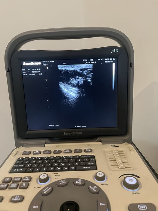 Ecografo Sonoscape A5