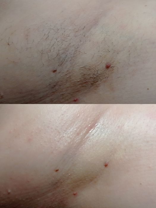 Депіляція воском/шугаринг Голосіївський