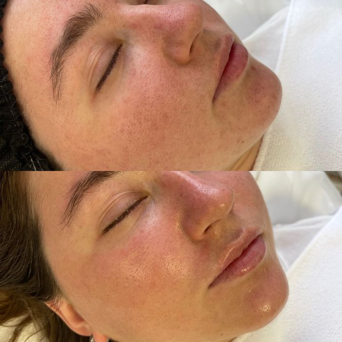 Косметолог:Чистка, пілінг,біоревіталізація, Позняки Драгоманова 2-Б