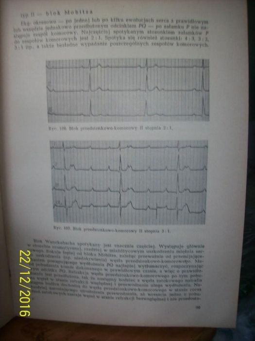 Książka Elektrokardiografia Praktyczna