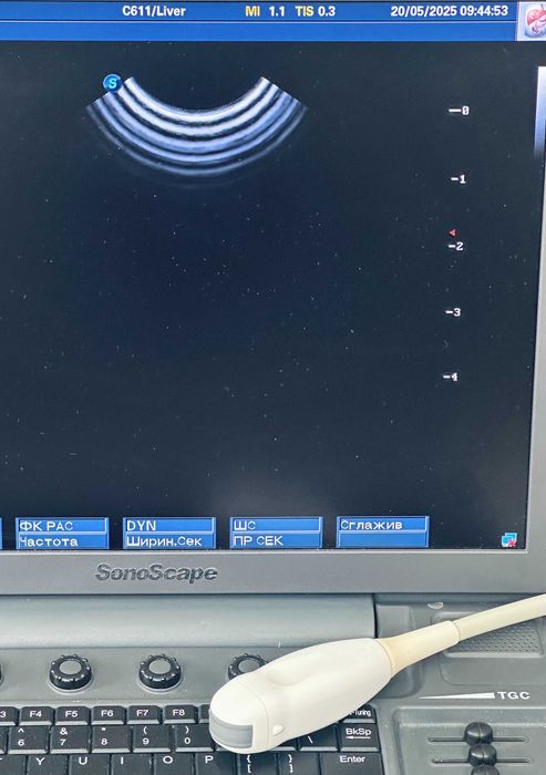 УЗИ\УЗД апарат SonoScape S8-Exp/Соноскейп/4 датчики/Еластографія/3D-4D