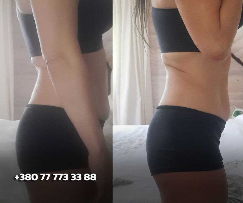 План харчування БЕЗ ЖОРСТКИХ ОБМЕЖЕНЬ. Услуги нутрициолога.Нутриціолог