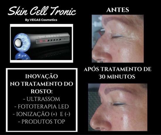 Skin cell tronic