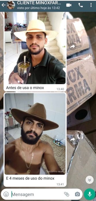 Minoxidil - original