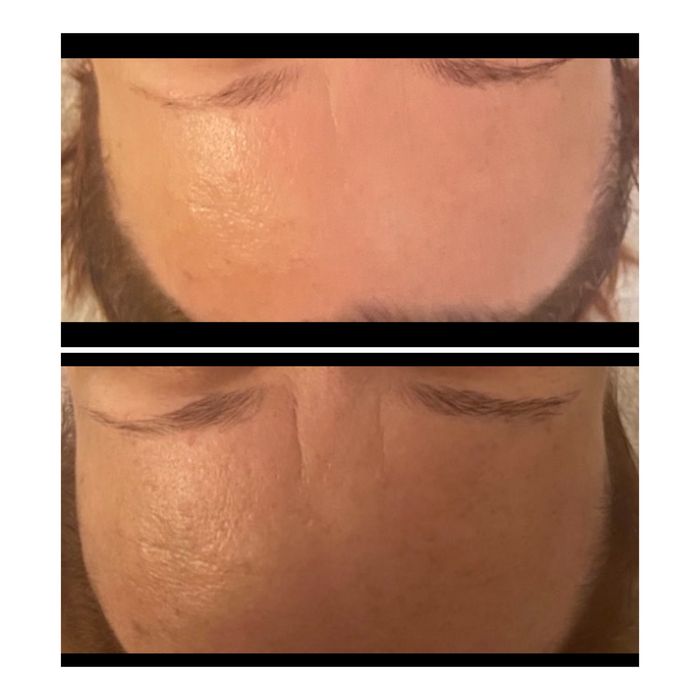 Masaz KOBIDO dla Kobiet - naturalny lifting twarzy + Oxy Bar gratis