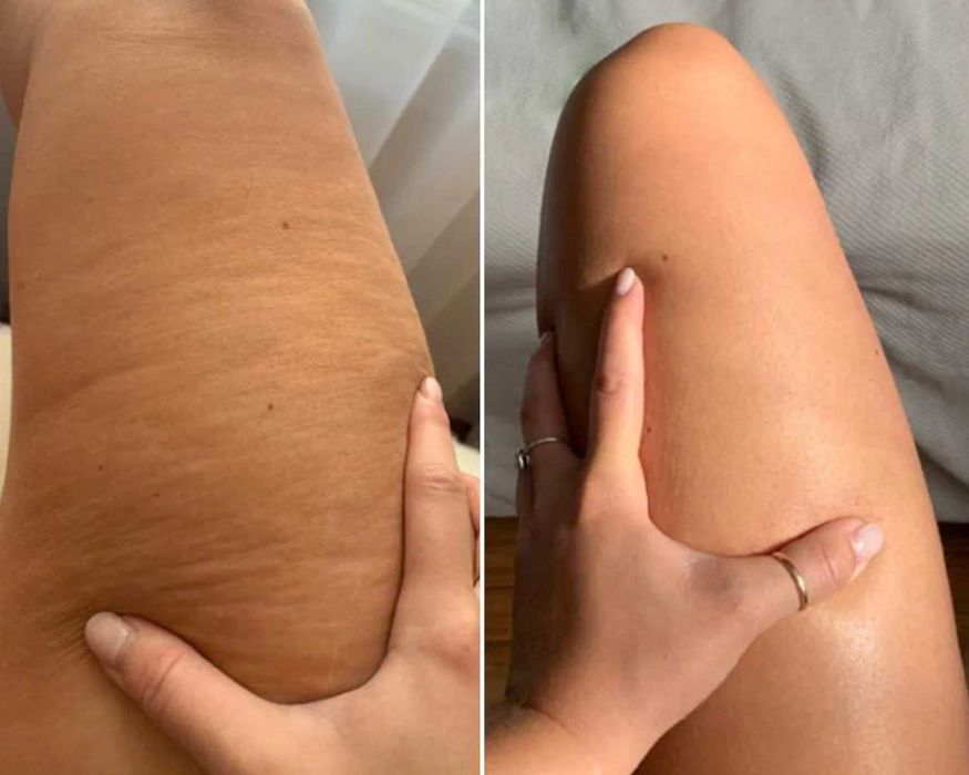 Masażer 9w1 Antycellulit PODCZERWIEŃ RELAKSUJĄCY Wyszczupla Ujędrnia