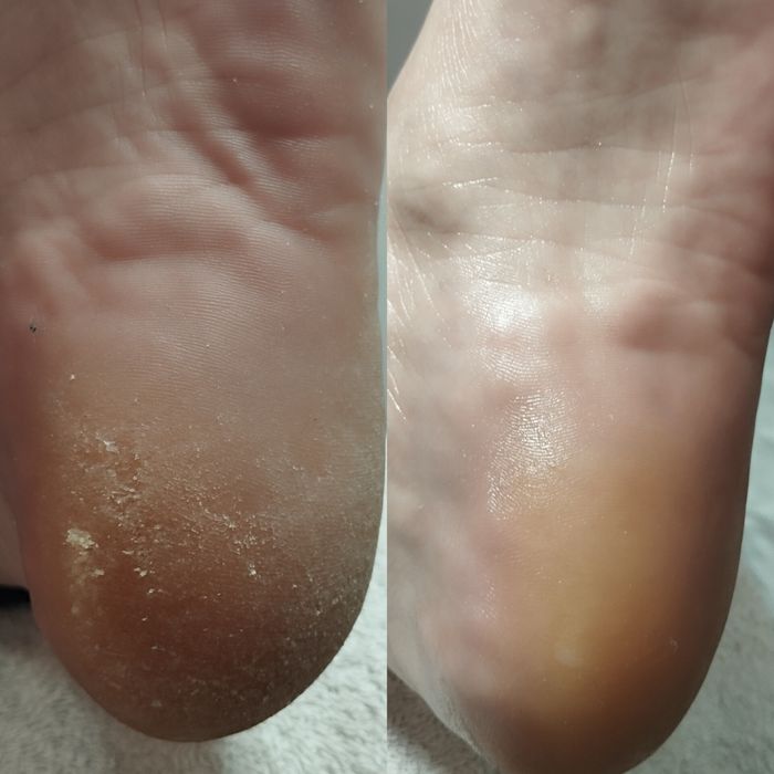 Pedy Clean, estética e cuidados específicos dos pés