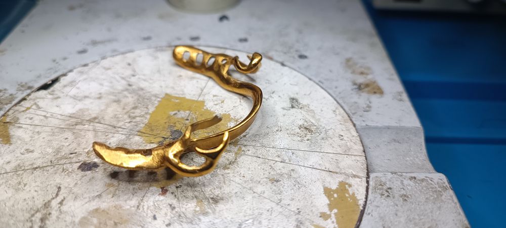 Стоматологическая позолота коронки