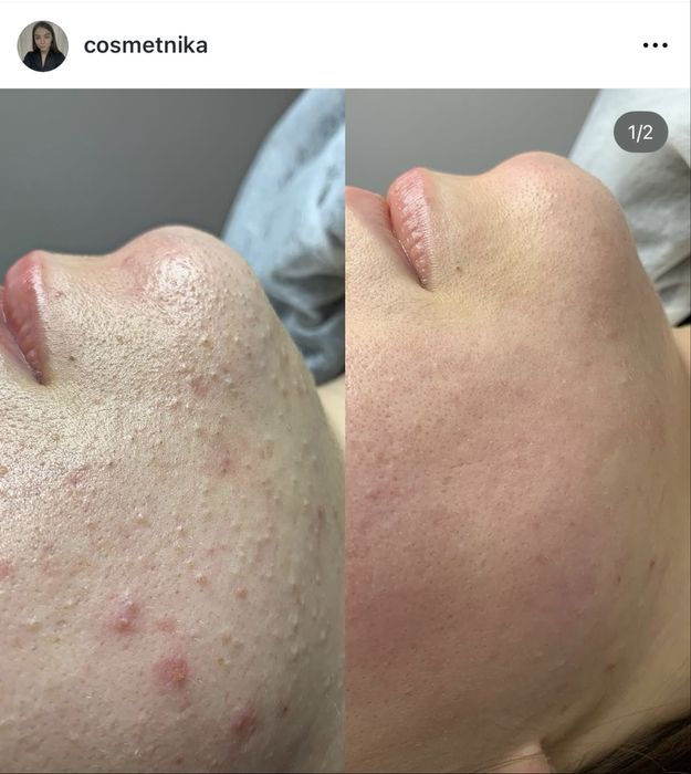 Косметолог  Лівий берег Дніпро