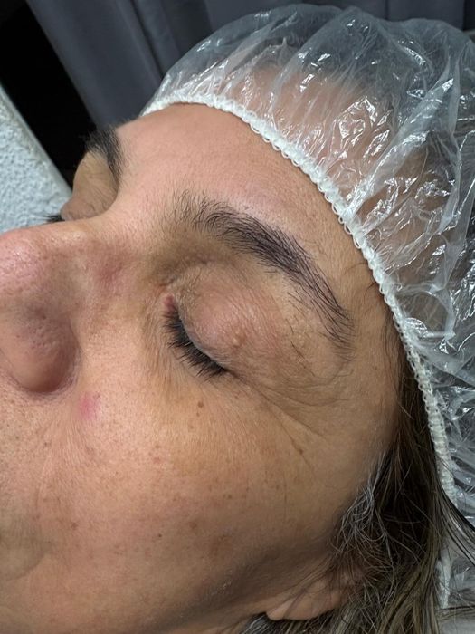 Epilação à linha ao domicilio