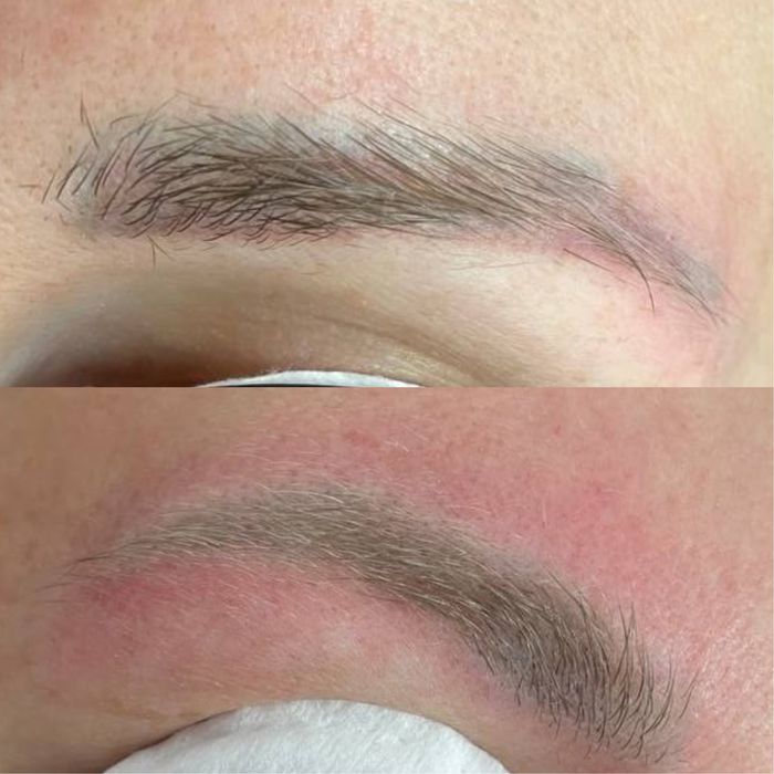 Видалення татуювання, перманенту