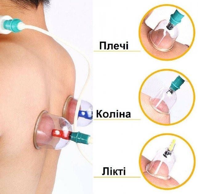 Вакуумные массажные банки магнитные JINKANG с насосом-вакууматором 32
