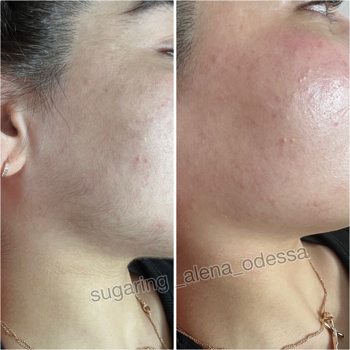 Шугаринг Воск Центр