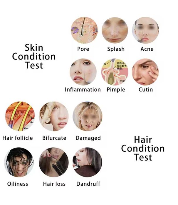 Máquina Analisador da pele, detector do couro cabeludo Baixa de Preço