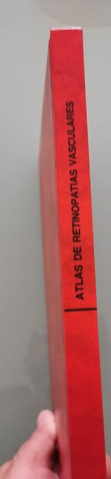 Atlas de Retinopatias vasculares