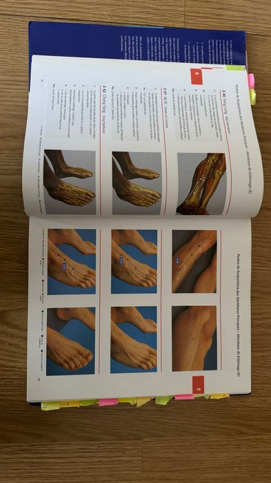 Atlas Gráfico de Acupuntura – Manual Ilustrado dos Pontos