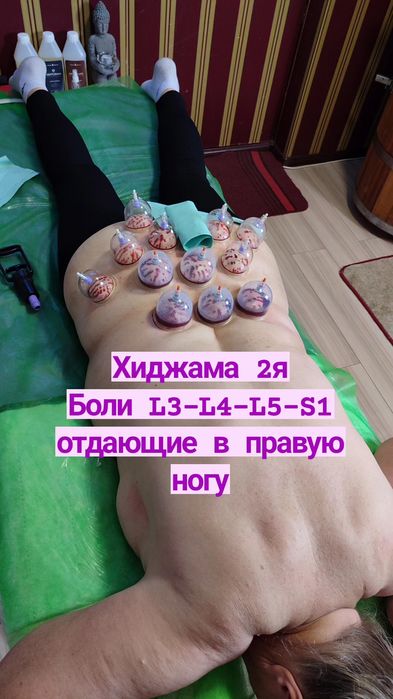 Обучение Хиджаме Харьков индивидуально и группой,  лично и онлайн