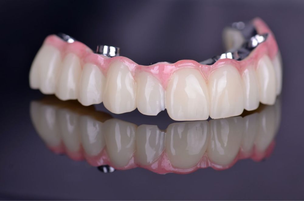 Зуботехнічна лабораторія пропонує співпрацю. Зубний технік.