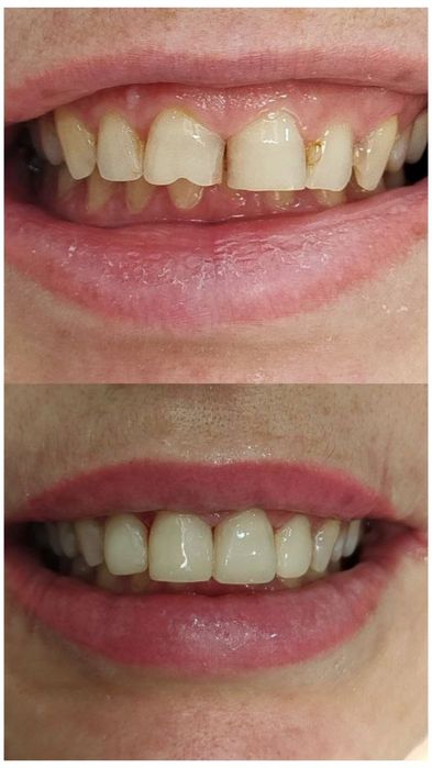 СтоматологОдесса , якісно ,безболісно, всі види стоматологічних послуг