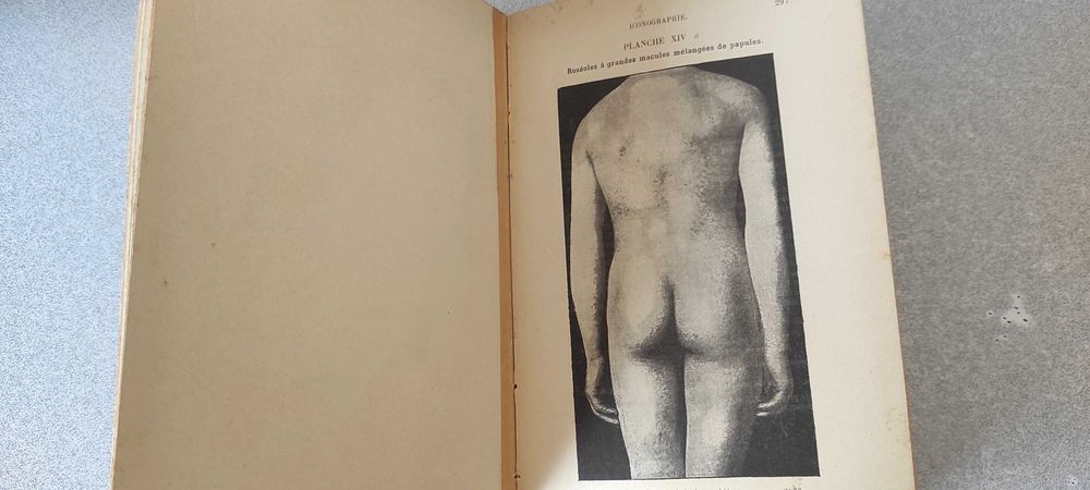 VENDO Livro raro - Mracek - Émery Atlas-Manuel des Maladies Vénérienne