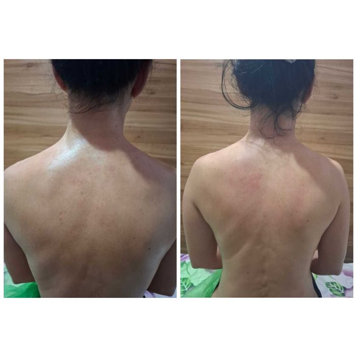 Масаж, міопресура, консультування, реабілітація. Трускавець