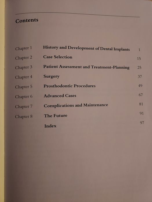 Livro de implantes dentários para generalistas.