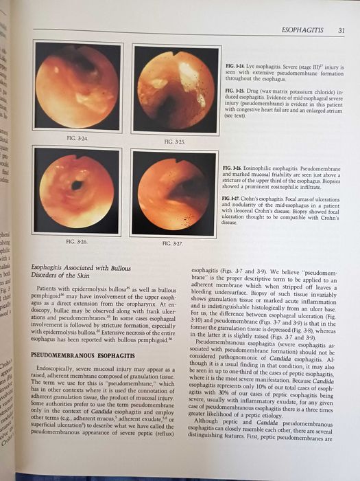 Endoscopic Interpretation (Blackstone)