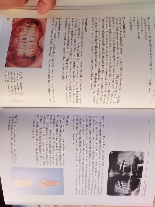 Livro de implantes dentários para generalistas.