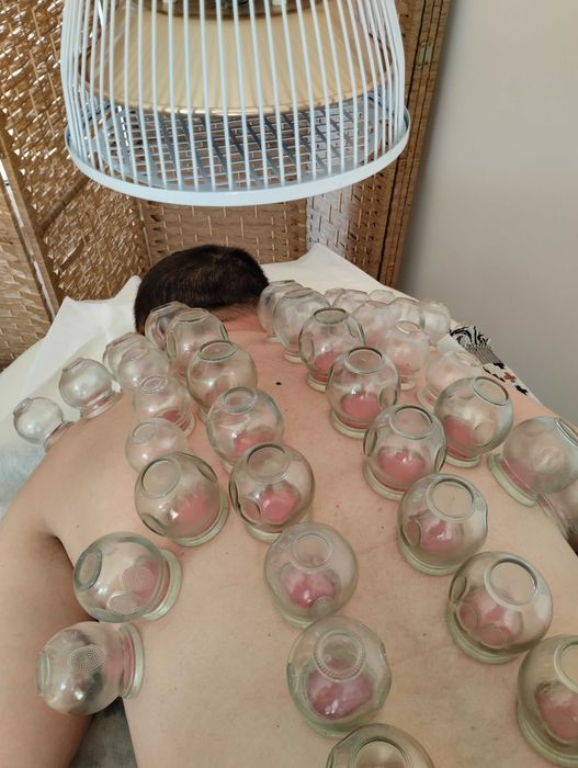 Terapia bańka ogniowa MiM Harmonia