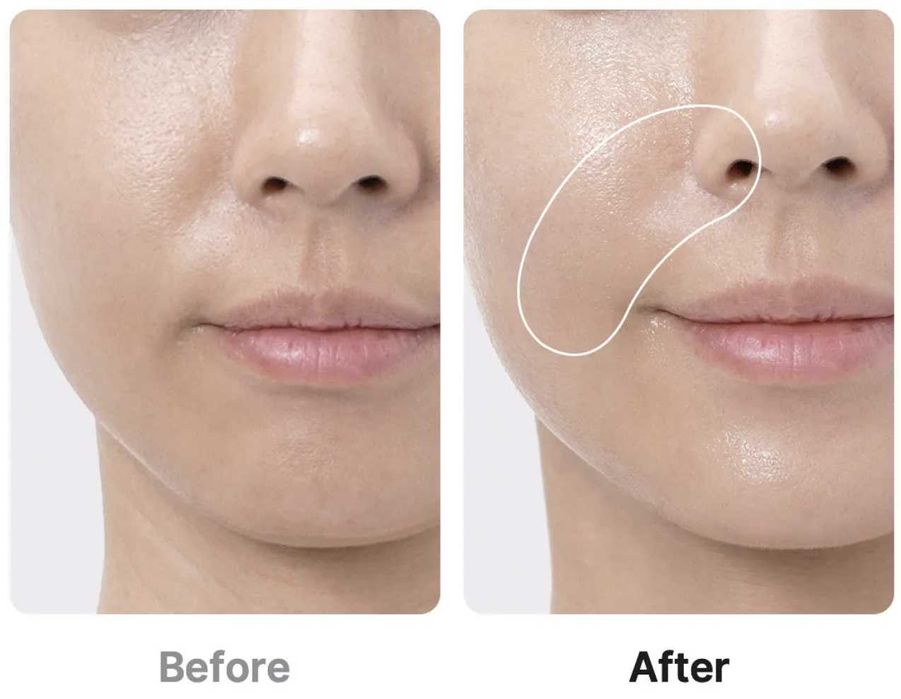 [Medicube] Age-R Booster Pro purple