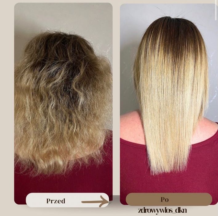 Nanoplastia , Botox , Rekonstrukcja , Regeneracja włosów