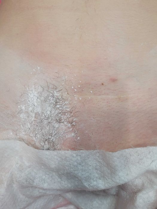 Депиляция/эпиляция жен/муж/подросток. Оформл. окраш. бровей.Черноморск