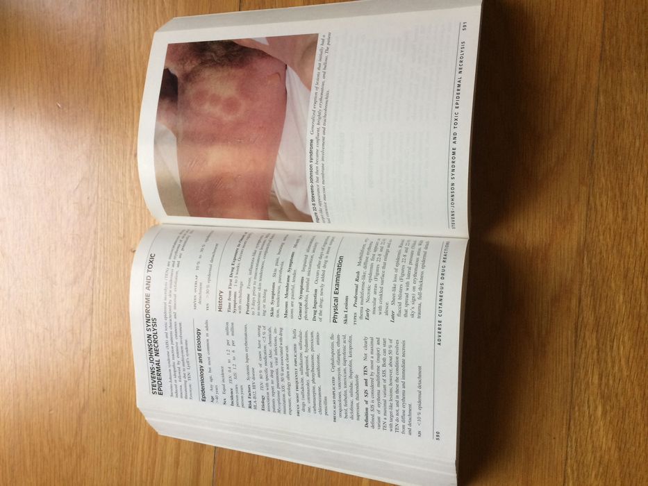 Color Atlas And Synopsis of Clinical Dermatology