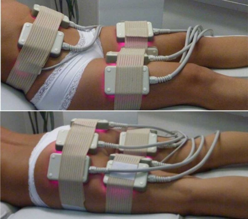 Equipamento de estética