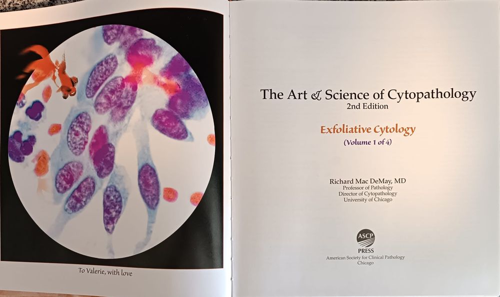 DeMay's 2a edição " Art & Science of Cytopathology" (4 volumes)