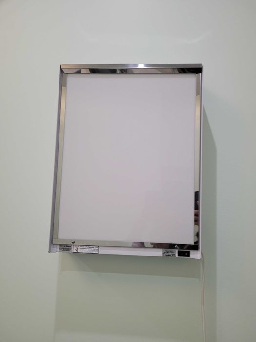 Negatoscópio 1 corpo, em chapa de aço inoxidável como novo