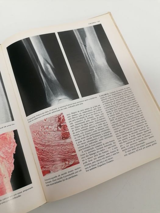 Coleção Livros Grande Enciclopédia Médica - Completa 6 Volumes