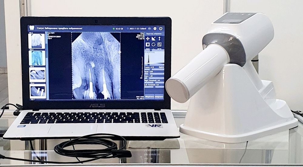 Візіограф PLUTO  HD, від найбільшого виробника сенсорів у світв