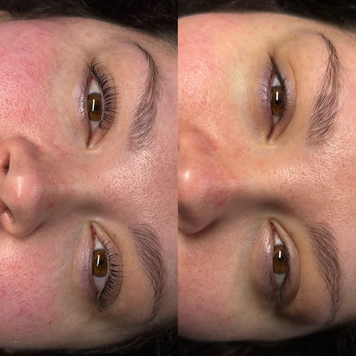 Koreańska Laminacja Rzęs