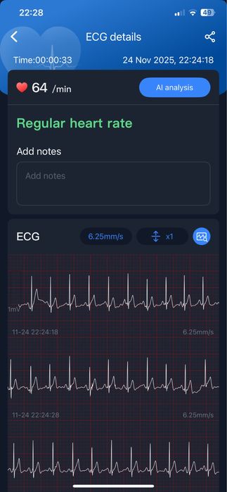 Персональний bluetooth кардіомонітор Wellue-DuoEK S EKГ Tracker ER2-SC