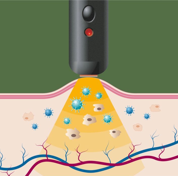 Herpotherm na opryszczkę