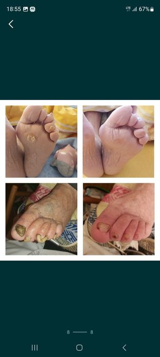 PODOLOG MOBILNY  Rataje  CAŁY POZNAŃ dla Seniorów Dojaz Pedicure