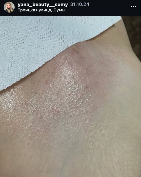 Жіночий Шугаринг | Троїцька | Центр