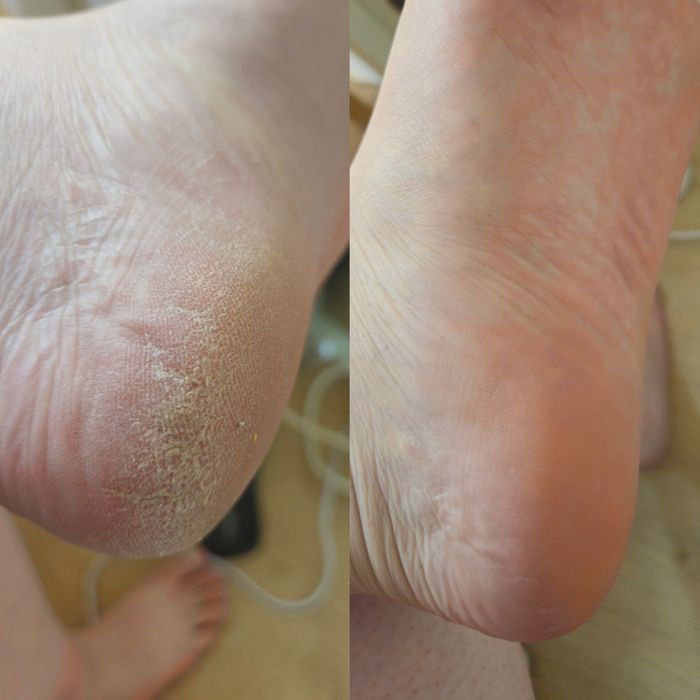 Imersão em pó, Gel molde F1, Acrygel  e Pedicure