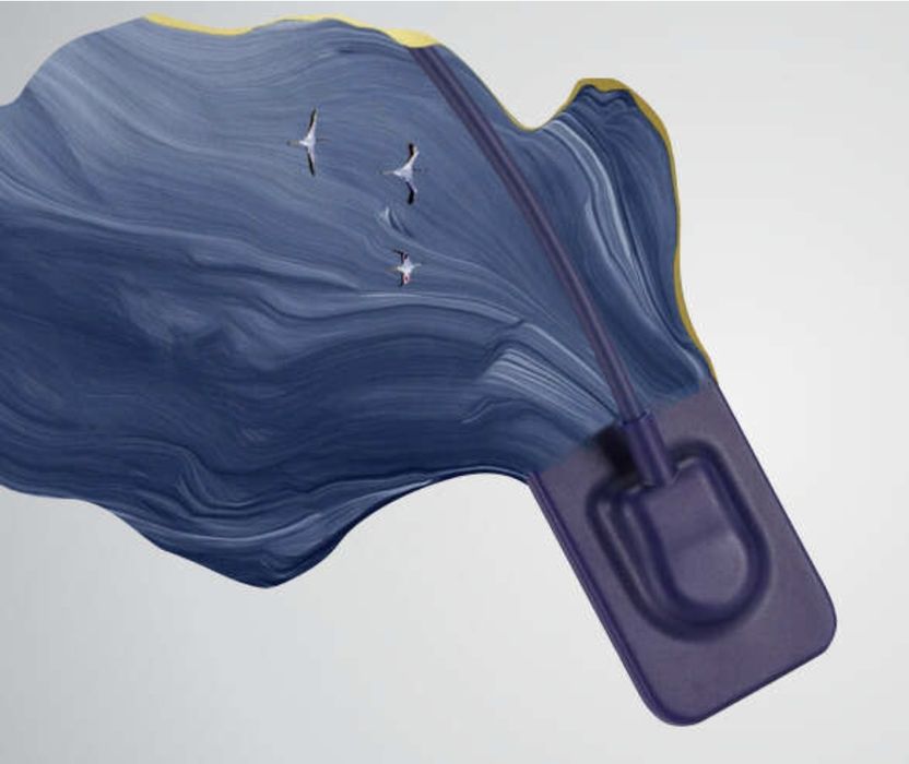 Візіограф PLUTO  HD, від найбільшого виробника сенсорів у світв