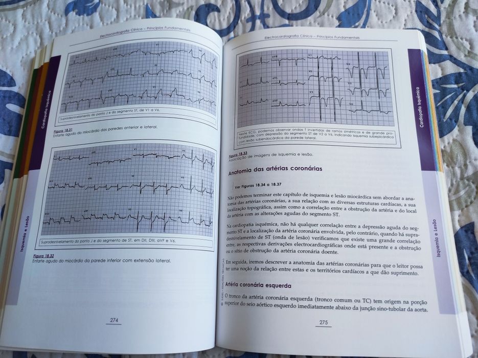 Electrocardiografia Clínica - J. C. Machado Rodrigues