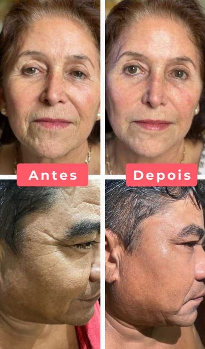 Age Reversist Crema Perfeccionadora botox Instantanea farmasi