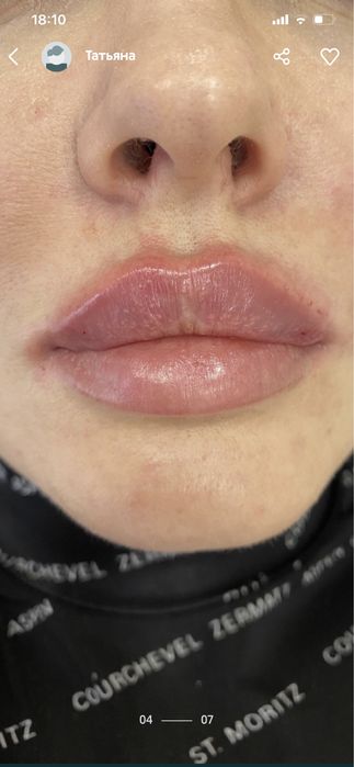 Врач-косметолог опыт более 15 лет для каждого! Кабинет в центре города