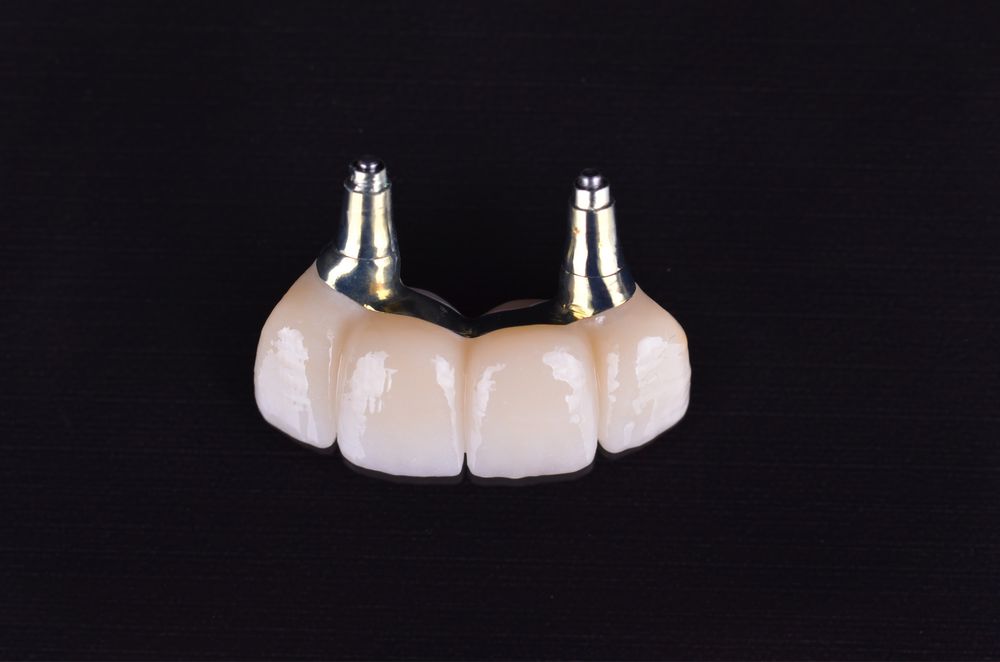 Зуботехнічна лабораторія пропонує співпрацю. Зубний технік.